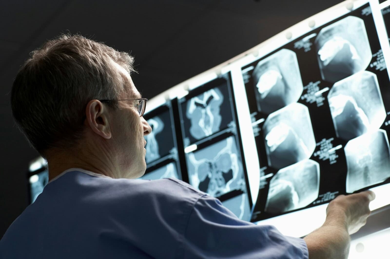 Doctor looking at x-rays