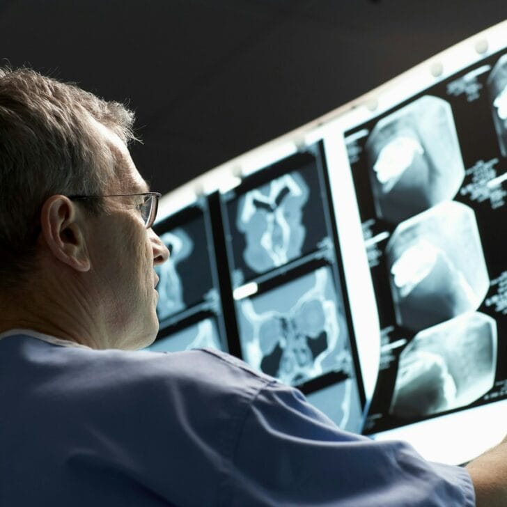 Doctor looking at x-rays